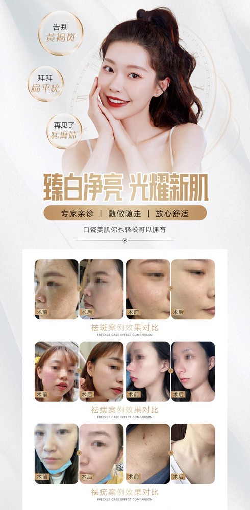 欢乐塑瘦身合作项目